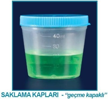 İSOLAB 087.02.001 numune beheri - non steril (1000 adet)