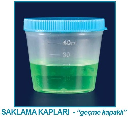 İSOLAB 087.02.002 numune beheri - steril (500 adet)